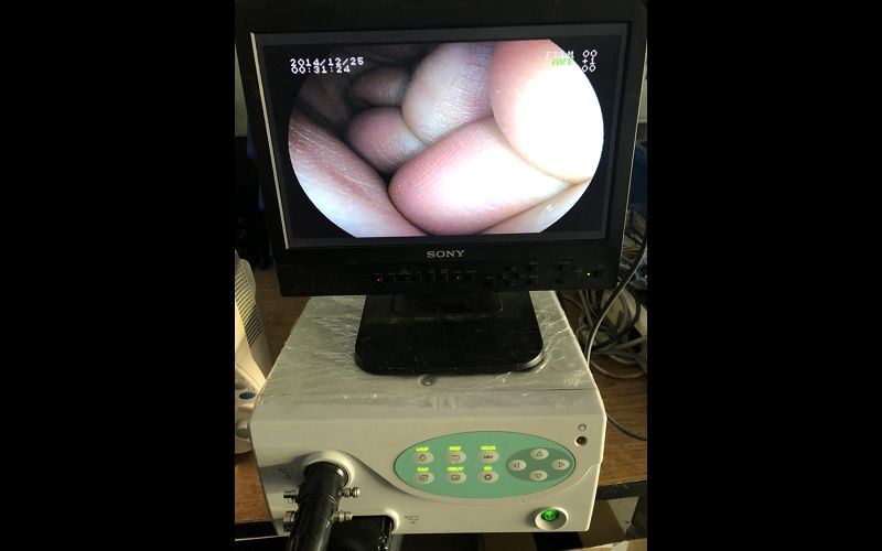 軟式內視鏡 廠牌 : FUJINON 型號 : EPX-2200