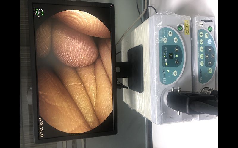 軟式內視鏡 廠牌 : FUJINON 型號 : VP-4400+XL-4400