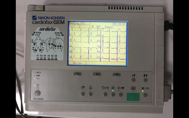 心電圖 廠牌:Nihon Kohden 型號: