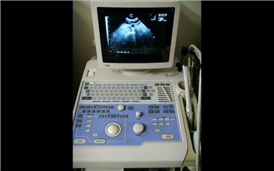 移動式超音波 廠牌 : Aloka 型號 : SSD-1100